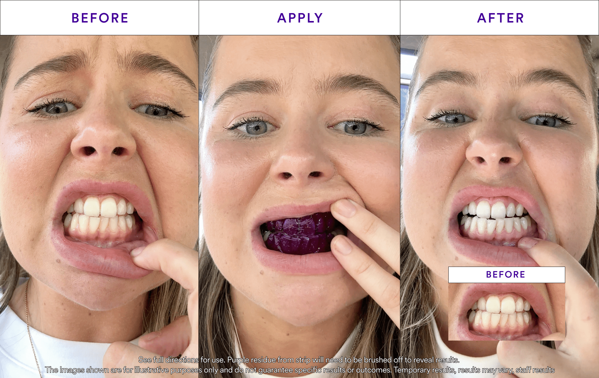 V34 Whitening Strips